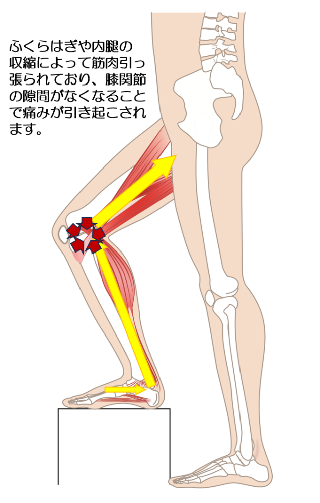 施術前
