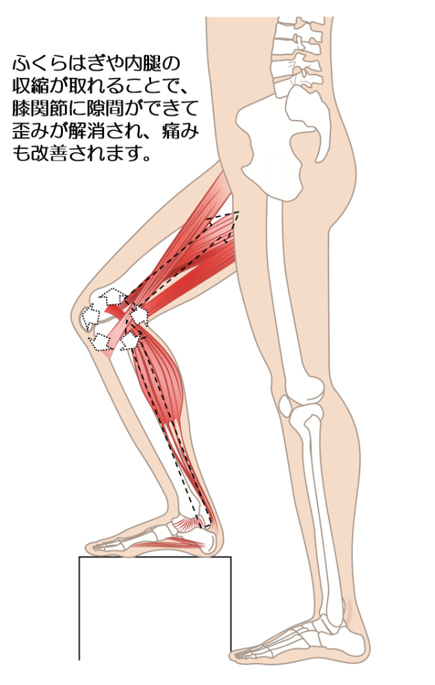 施術後